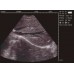 Ультразвуковий сканер MS Multiscan